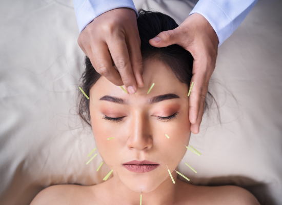 acupuncture-in-edmonton