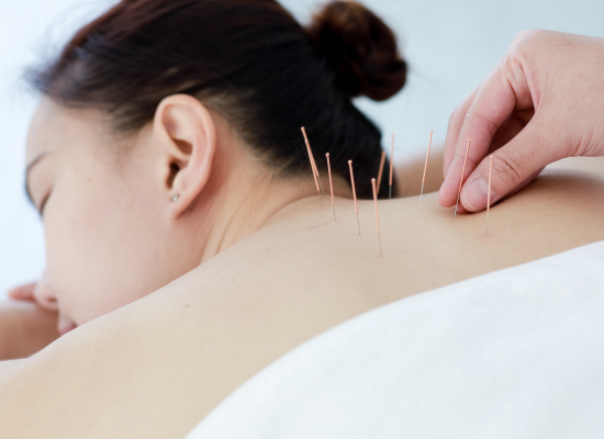 acupuncture-in-edmonton